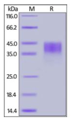 Human CD200, His Tag on SDS-PAGE under reducing (R) condition. The gel was stained overnight with Coomassie Blue. The purity of the protein is greater than 98%.